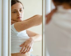 Что делать, если у вас аллергия на укусы комаров и мошек