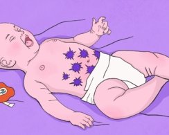Что делать, если у новорождённого колики или фиолетовый плач